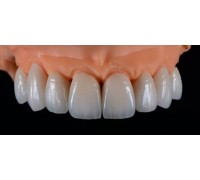 China Denture Dental lab & Zirconia Dental Crown factories